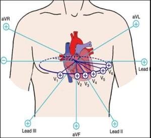 12 lead ecg vectors