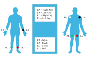 12 Lead ECG Placement Guide